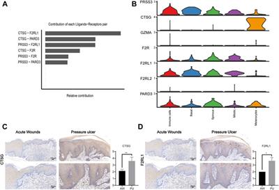 Single-cell analysis reveals melanocytes may promote inflammation in chronic wounds through cathepsin G